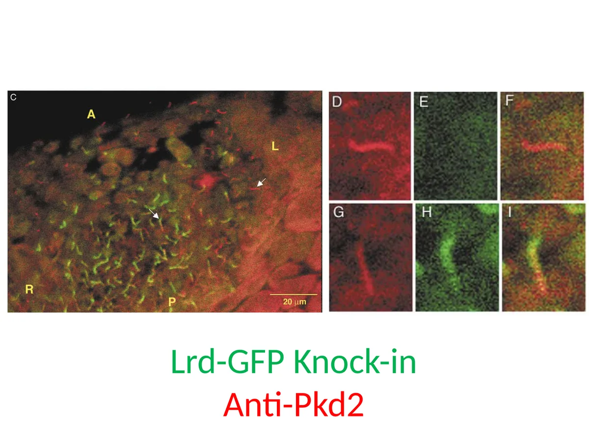 לוקליזציה של PKD2 ב־primary cilia: Lrd-GFP מסמן סיליות נעות, ו־Anti-Pkd2 מסמן את PKD2.