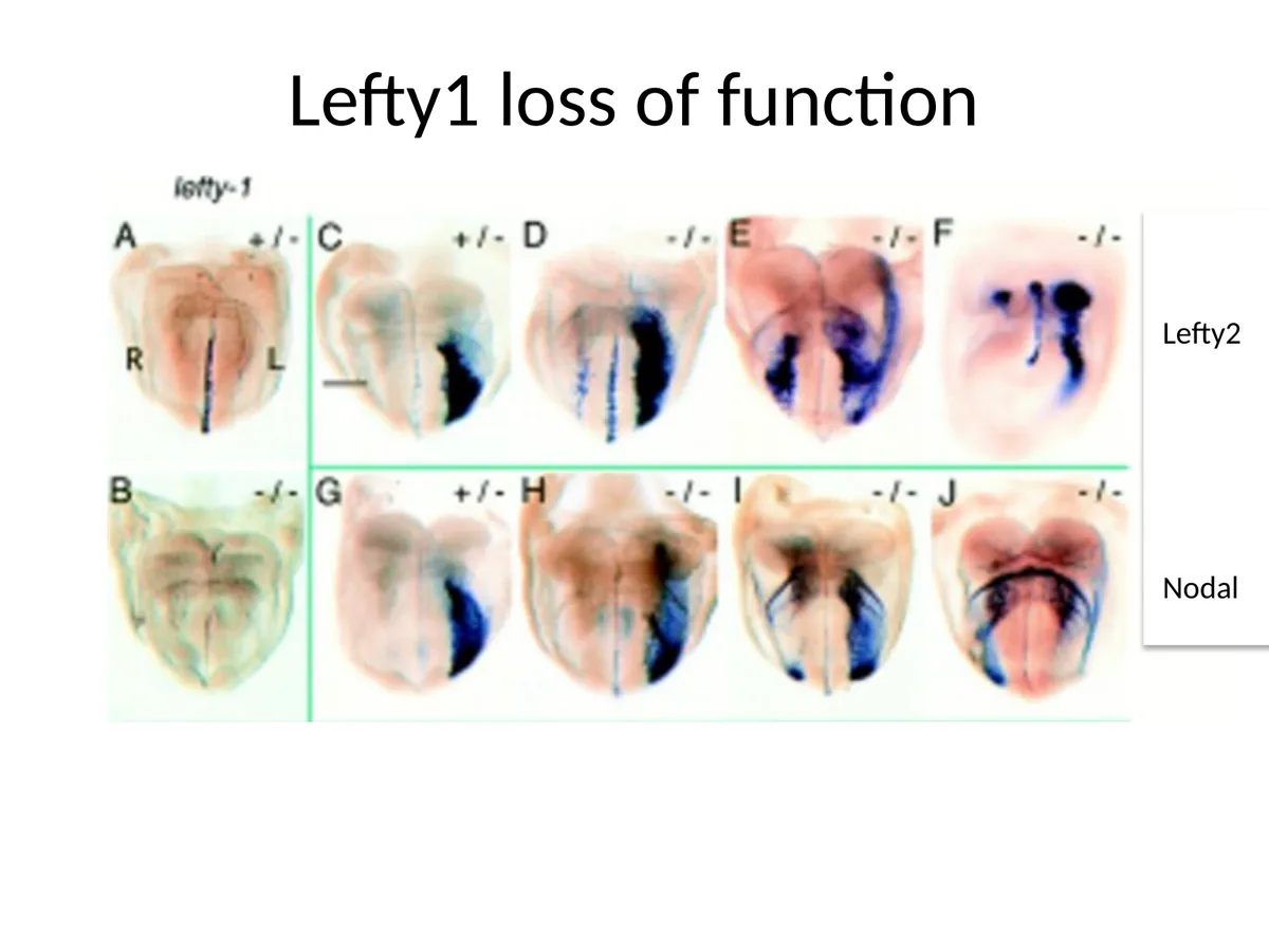 Lefty1 loss of function: ביטוי Nodal/Lefty2 יכול להופיע באופן דו־צדדי.