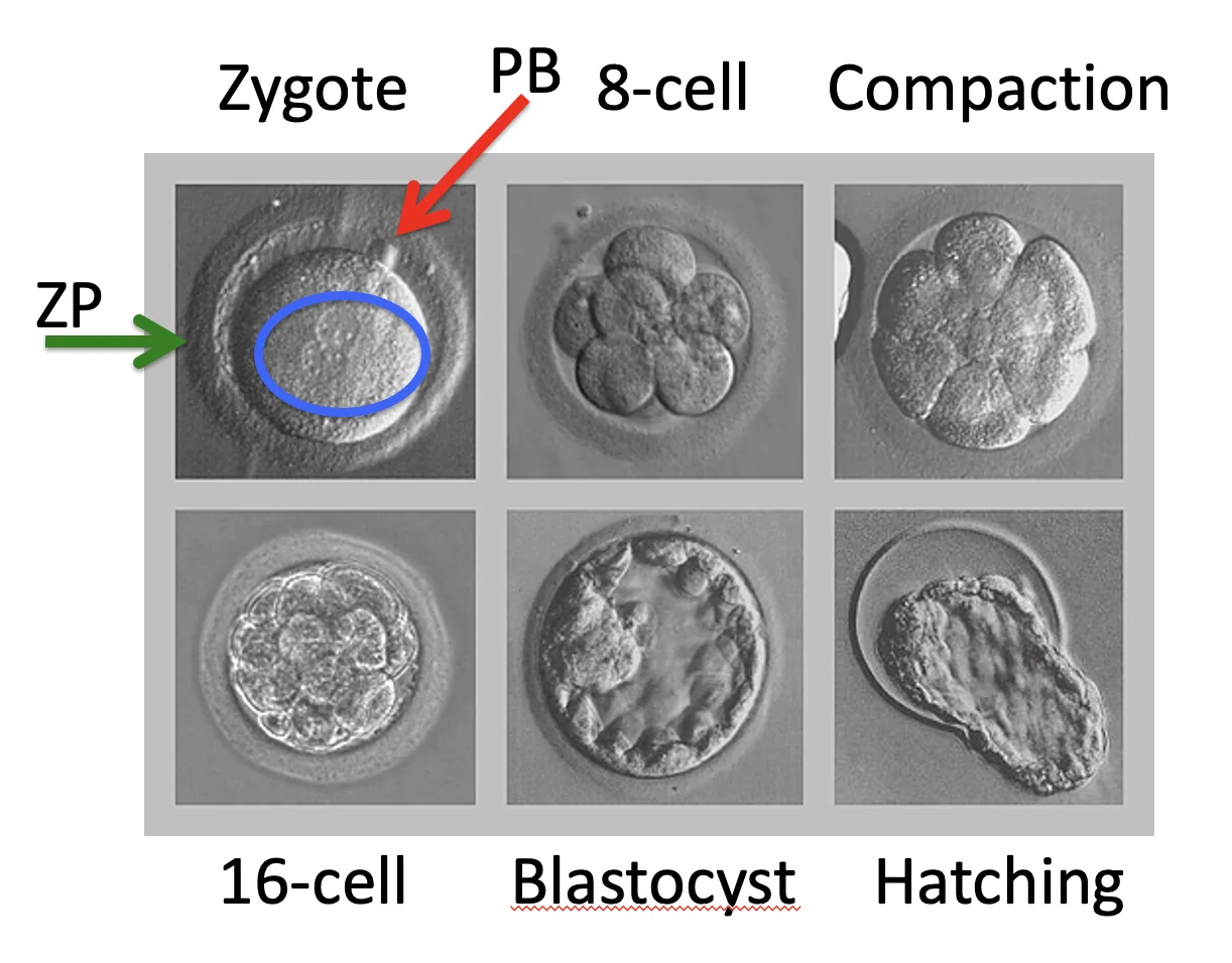 Zygota, PB, ETC