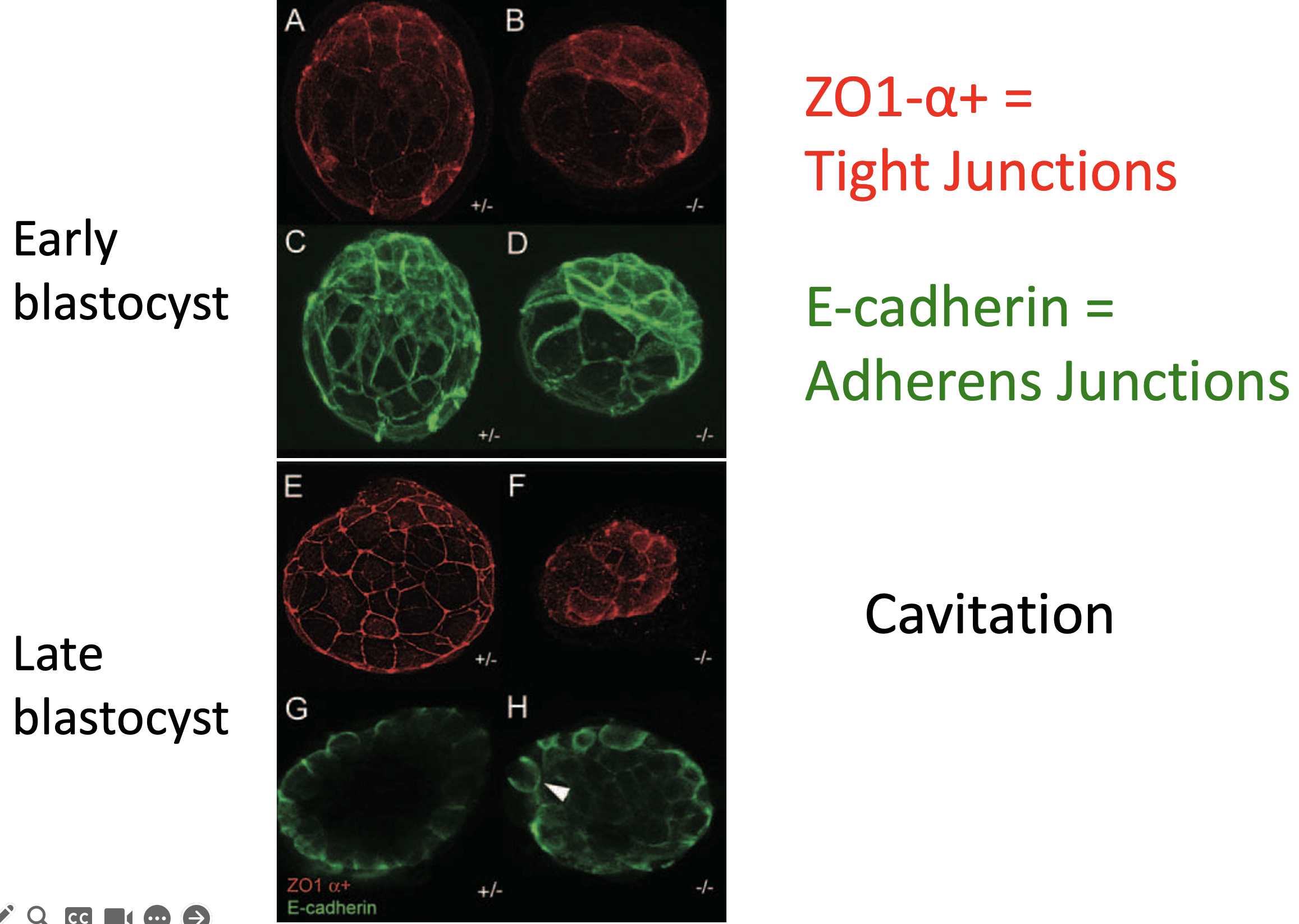To evaluate the degree of TE differentiation in Cdx2–/– embryos, we examined the expression of TE-specific markers. One of the characteristics of the TE epithelium is the formation of tight junctions between the TE cells, which facilitate the maintenance of the blastocoel cavity. As Cdx2 homozygous mutants fail to maintain an expanded blastocoel, we examined the expression of the tight junction and adherens junction components in Cdx2 mutant embryos during development. ZO-1α – and ZO-1α + (encoded by Tjp1 ) incorporate into tight junctions early and late during TE formation, respectively (Sheth et al., 1997). E-cadherin localization to the basolateral adherens junctions precedes tight junction formation (reviewed by Fleming et al., 2000; Fleming et al., 2001). Both tight and adherens junctions appeared grossly normal in early blastocysts of both mutant and non-mutant genotype, as assessed by expression of ZO-1α + (four mutants, 15 nonmutants; Fig. 3A,B), ZO-1α - (six mutants, 21 non-mutants; not shown), and E-cadherin (10 mutants, 46 non-mutants; Fig. 3C,D). By contrast, both tight and adherens junctions appeared abnormal in most mutants by the late blastocyst stage. In particular, ZO-1α + appeared patchy or diffuse compared with littermates (7/8 mutants; 12 non-mutants; Fig. 3E,F), while ZO-1α - was diffuse (3/3 mutants, five non-mutants; not shown). E-cadherin expression was still observed in Cdx2–/– blastocysts but appeared to be mislocalized basally in some cells of the TE (6/6 mutants, 13 non-mutants; Fig. 3G,H). These observations suggest that the polarity and integrity of the TE epithelium, while initially normal, is not maintained in the absence of zygotic Cdx2.