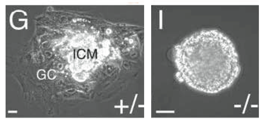 (G-I) Trophoblast outgrowth formation assay. Blastocysts (3.5 dpc) from Cdx2+/– intercrosses were individually cultured in tissue culture plates uncoated or pre-coated with ECM substrate. (G) Outgrowth of a Cdx2+/– embryo. (H,I) Cdx2–/– embryos failed to attach, and formed a rounded mass of cells devoid of a typical blastocoel. Parietal endoderm cells were detected in some Cdx2–/– embryos cultures (K; arrowheads).