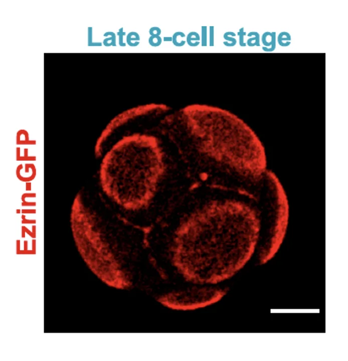 Ezrin-GFP