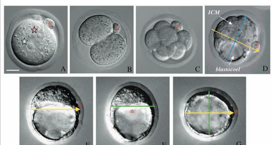 Fig. 1. Pre-implantation development of the mouse embryo from the zygote to the blastocyst stage. (A) Fertilised egg with visible female (pink star) and male (blue star) pronuclei and polar body marking the animal pole (red asterisk). (B) Two-cell stage embryo. (C) Eight-cell stage embryo. (D) Early blastocyst showing its animal-vegetal (yellow) and embryonic-abembryonic (blue) axes. (E-G) Expanding blastocyst seen from three different perspectives to show its bilateral symmetry. (E) View from the side, focused on plane of bilateral symmetry to show the long axis (yellow) of the ICM. (F) View from the animal pole to show the short axis (green) of the ICM. (G) View from the embryonic pole to show both long and short axes of the ICM. Scale bar: 25 mm.