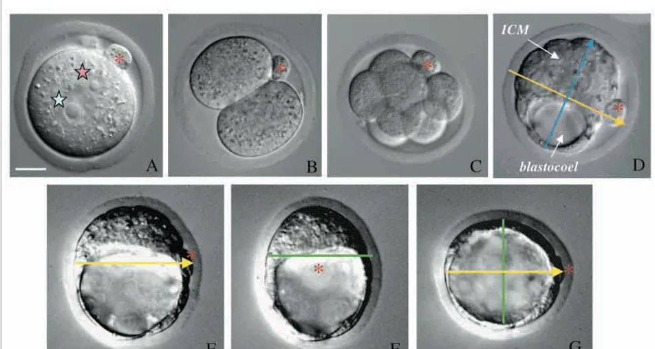 Fig. 1. Pre-implantation development of the mouse embryo from the zygote to the blastocyst stage. (A) Fertilised egg with visible female (pink star) and male (blue star) pronuclei and polar body marking the animal pole (red asterisk). (B) Two-cell stage embryo. (C) Eight-cell stage embryo. (D) Early blastocyst showing its animal-vegetal (yellow) and embryonic-abembryonic (blue) axes. (E-G) Expanding blastocyst seen from three different perspectives to show its bilateral symmetry. (E) View from the side, focused on plane of bilateral symmetry to show the long axis (yellow) of the ICM. (F) View from the animal pole to show the short axis (green) of the ICM. (G) View from the embryonic pole to show both long and short axes of the ICM. Scale bar: 25 mm.