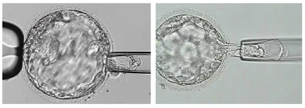 PGD: Blastocyst stage