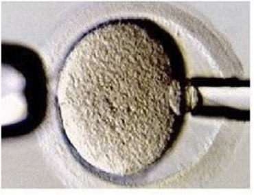Oocyte pre-fetillization