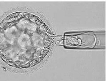 Day 5-7 blastocyst
