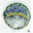 Blastocyst