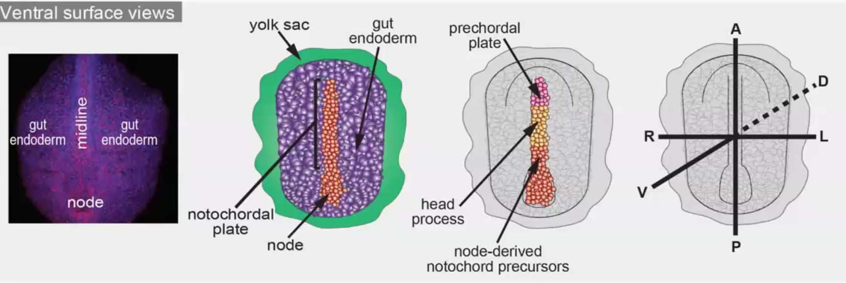 notochord