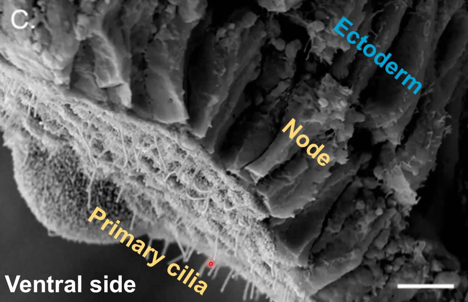 Primary cilia