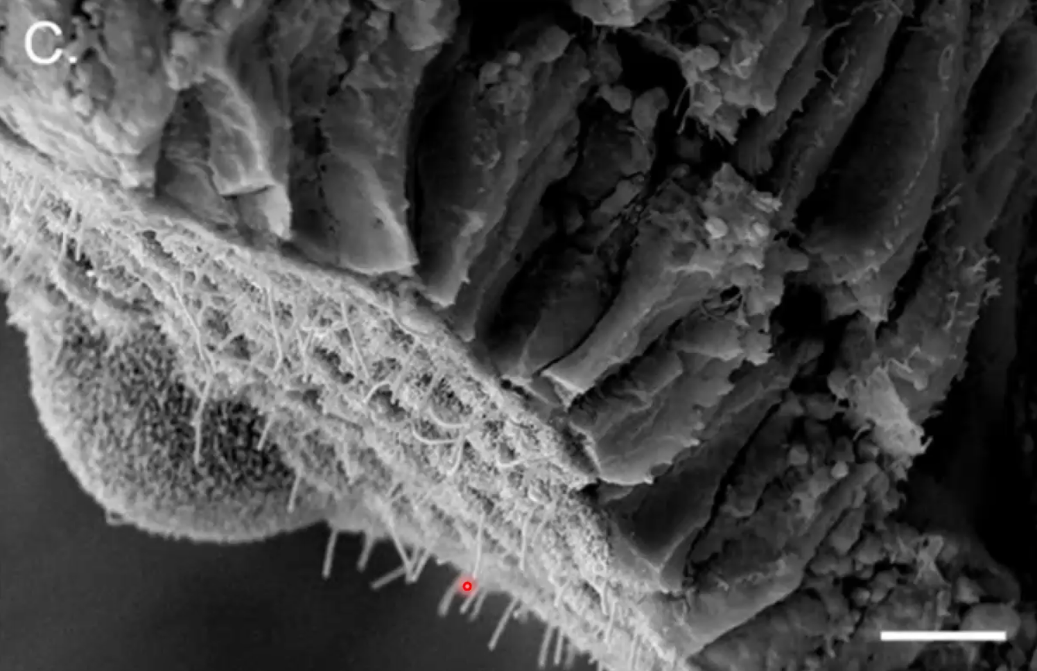 Primary cilia
