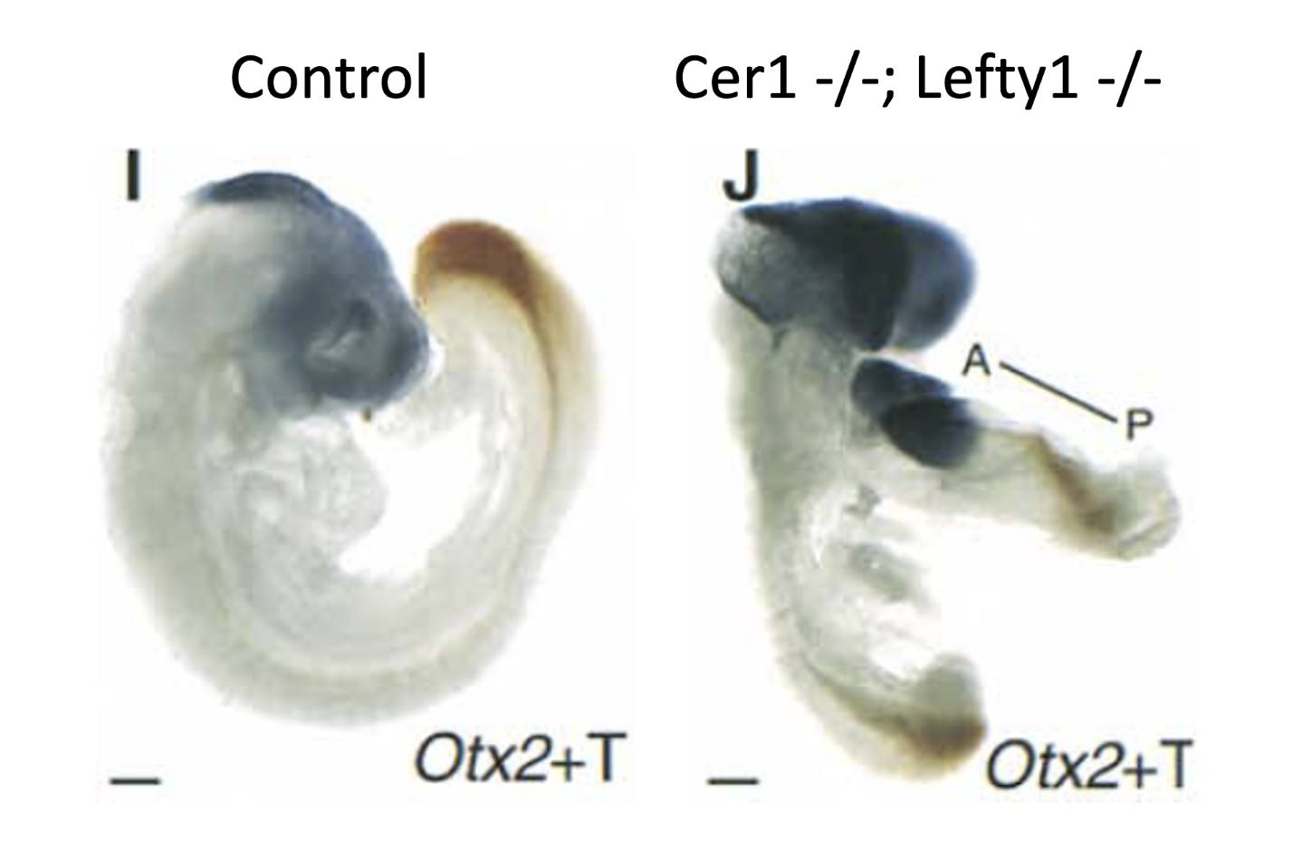 OTX2