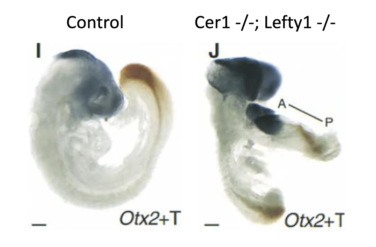 OTX2