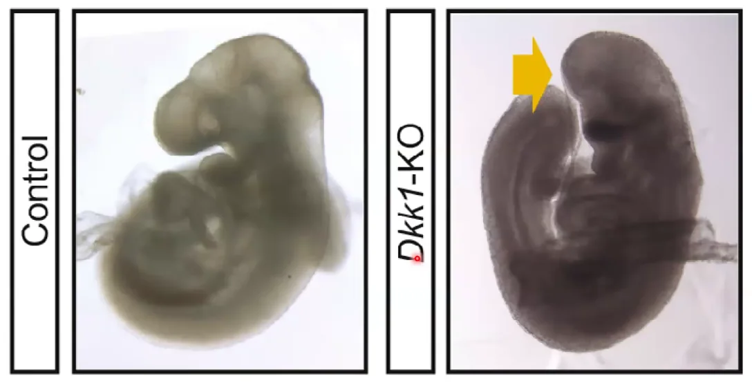 DKK1 KO