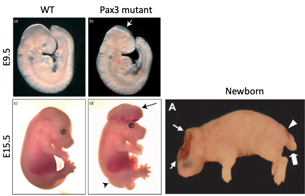 Figure 3-Phenotypic appearance of NTDs in the mouse. In wild-type embryos (a, c) closure of the cranial neural tube is complete by E9.5 (a) and failure of closure (arrow in b) leaves a region of open neural folds (covering the midbrain in the Pax3 mutant example shown), which is the first stage of exencephaly. At later stages (E15.5 shown), exencephaly appears as a protrusion of nervous tissue in the cranial region (arrow in d), the same fetus also has open spina bifida (arrowhead in d)