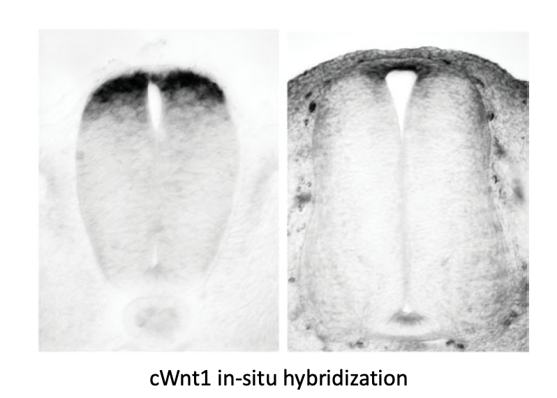 Wnt signaling בצד הדורסלי