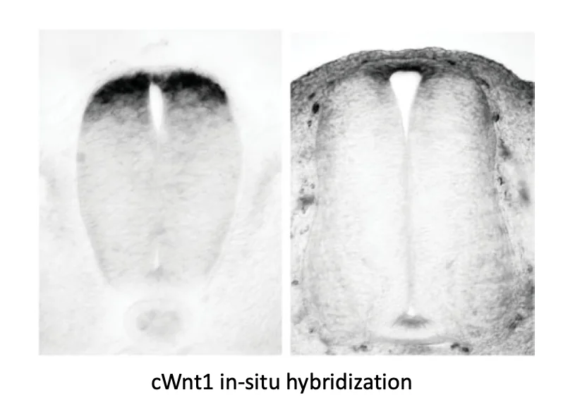 Wnt signaling בצד הדורסלי