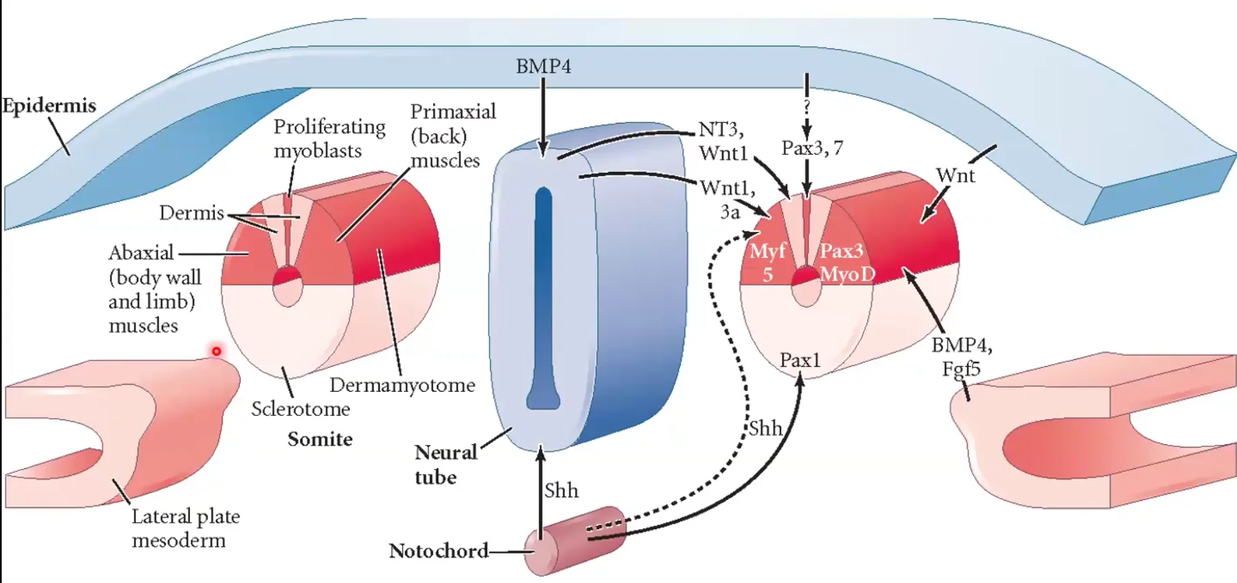 Somie Differentiation