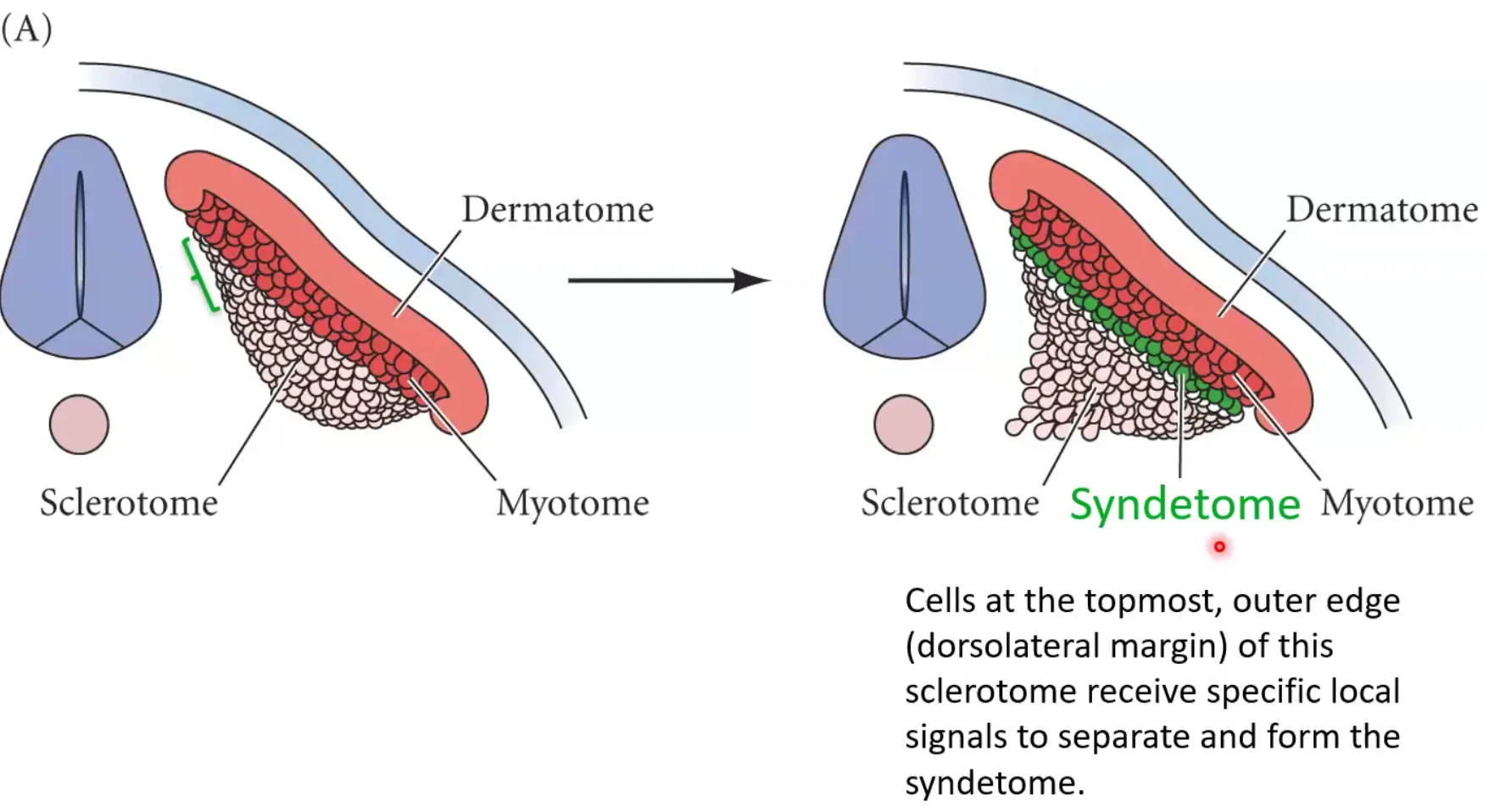 Syndetome
