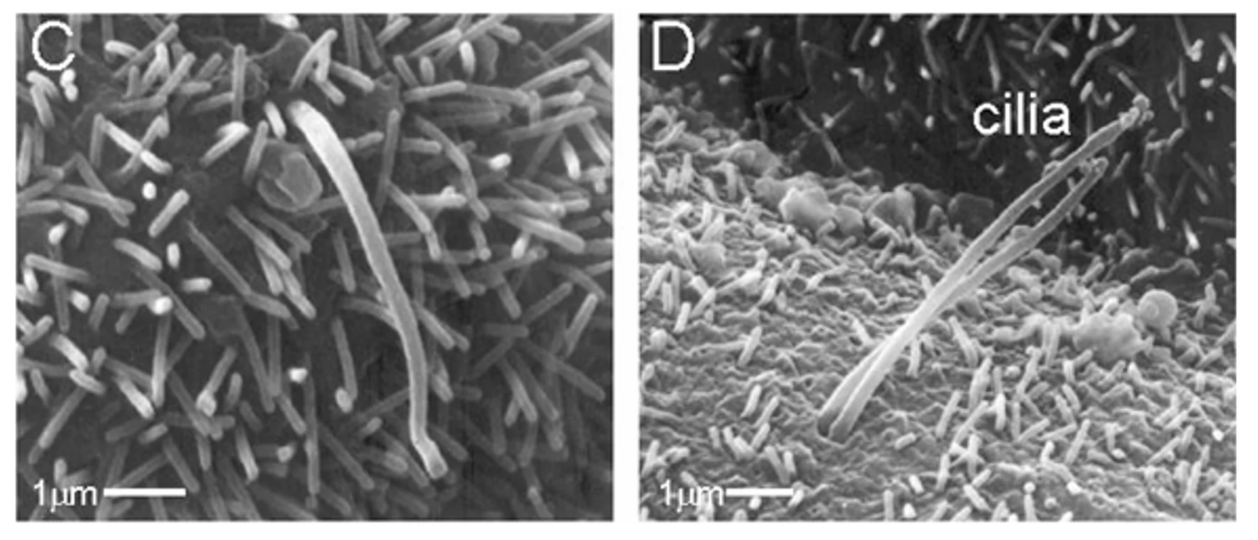 primary Cilia