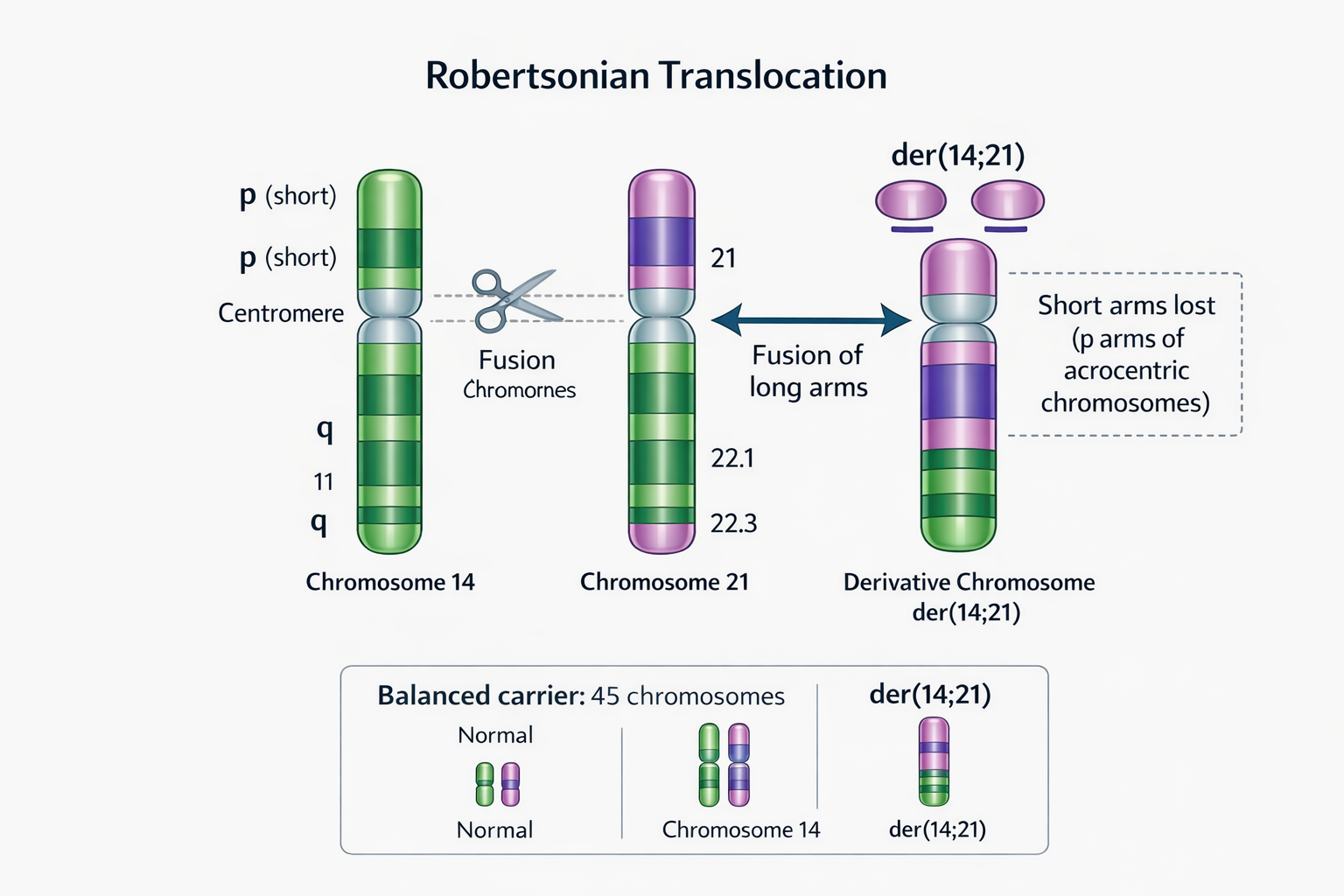טרנסלוקציה רוברטסונית