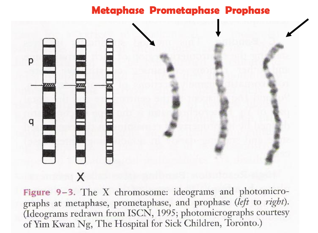 The banding of chromosomes can change according to the chromosome length
