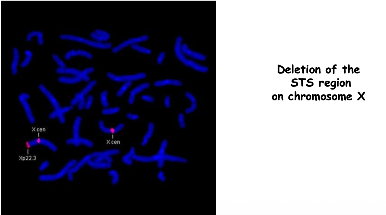 Deletion of chromosomal areas