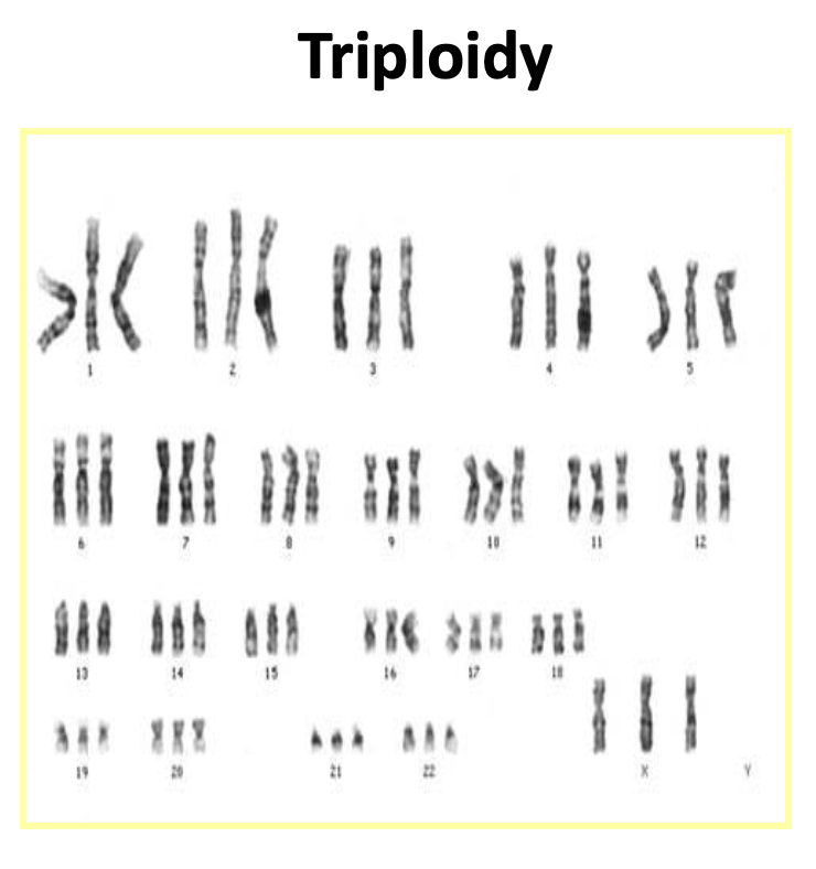 Triploid