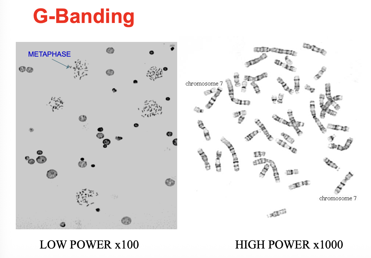 G-Banding