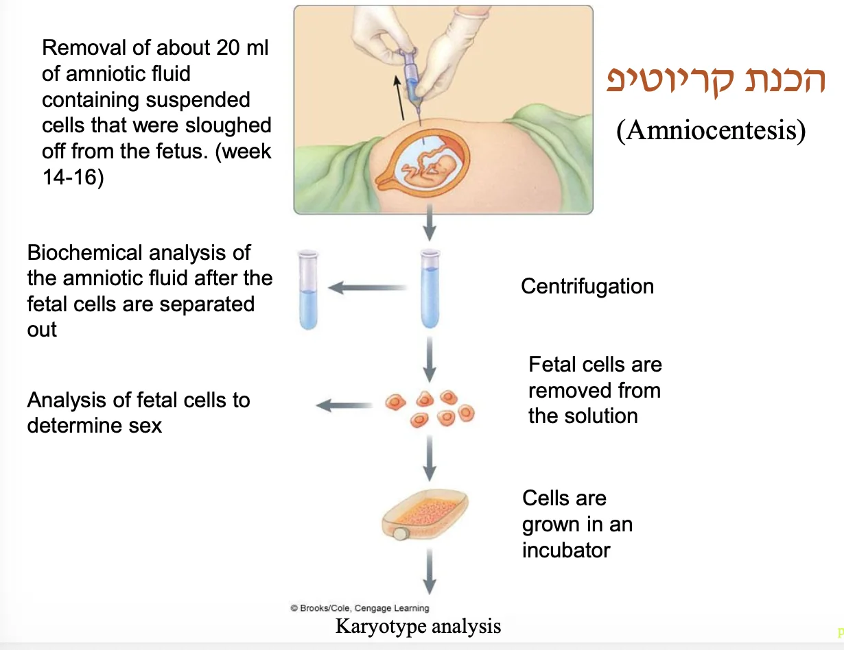 Amniocentesis
