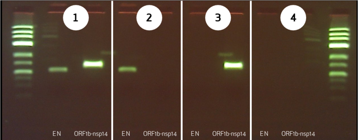 The possible valuations of the SARS-CoV-2 RT-PCR test