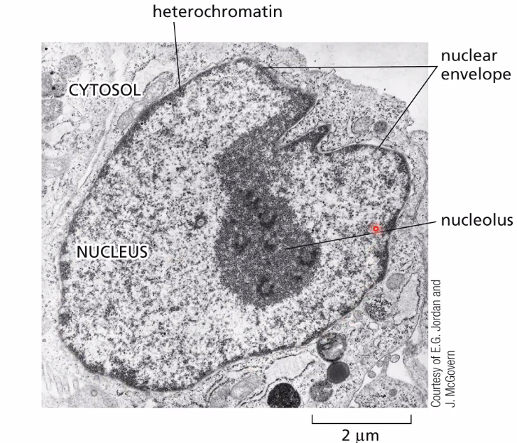 Euchromatin and Heterochromatin