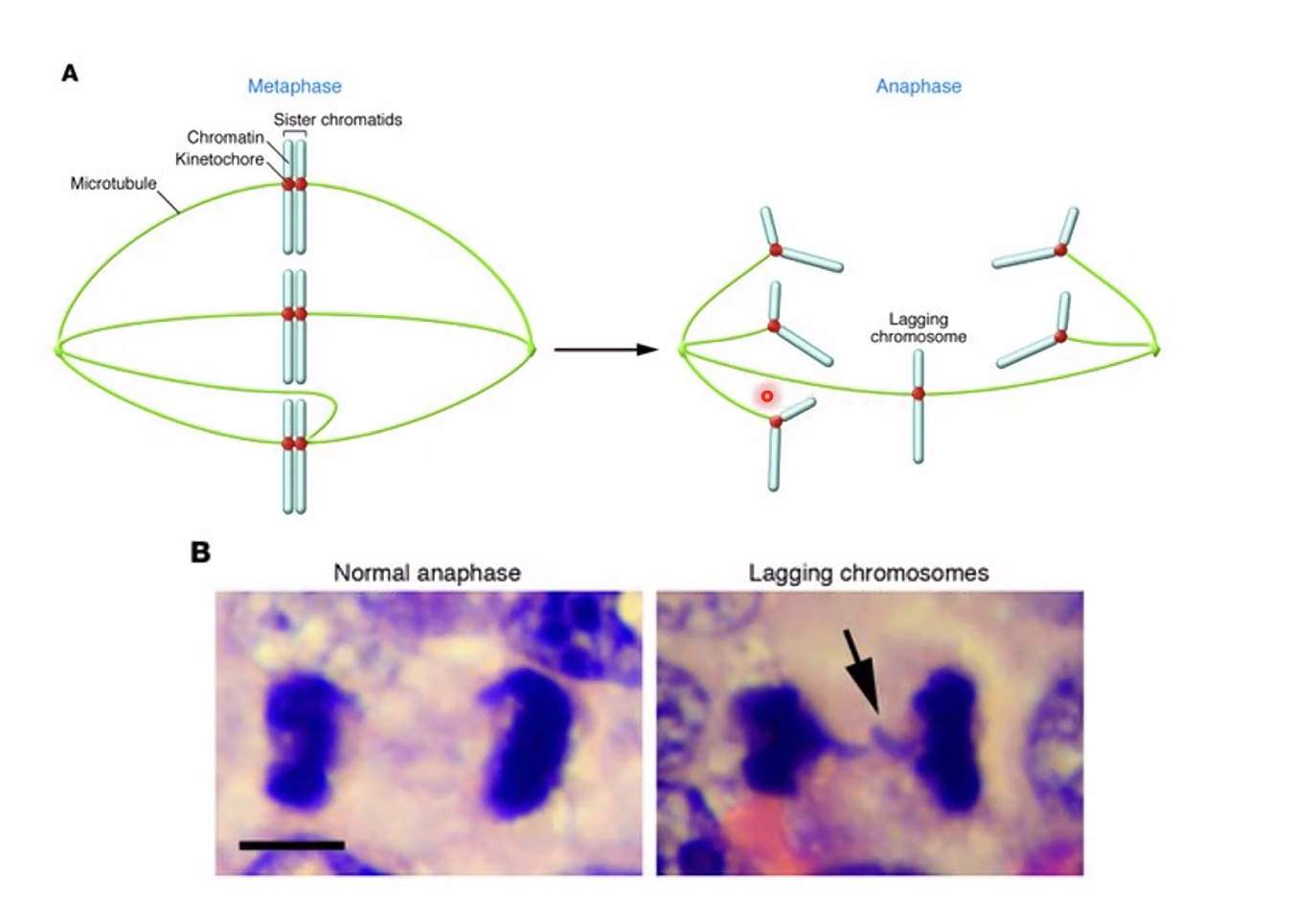 lagging chromosome