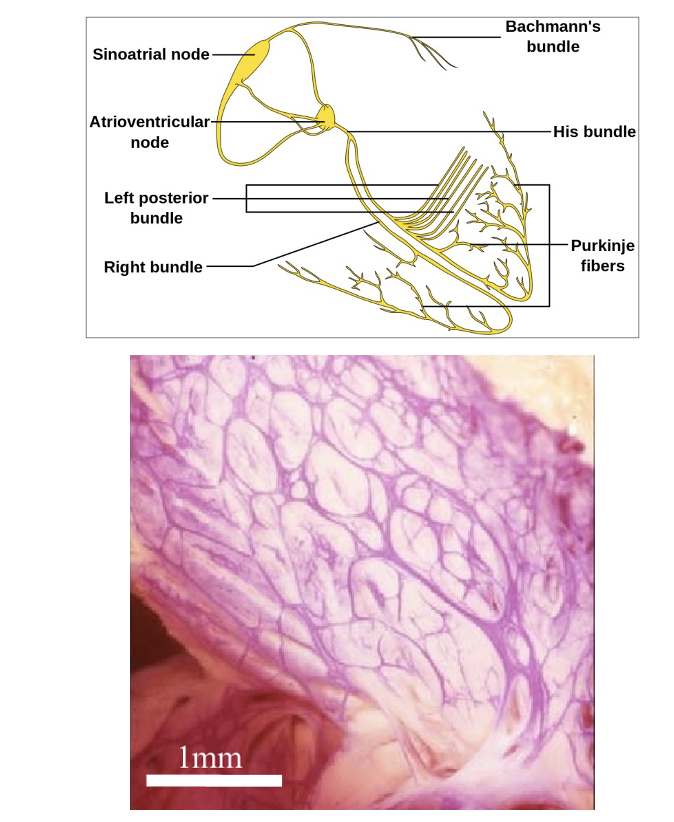 The Conduction System of the Heart - Purkinje