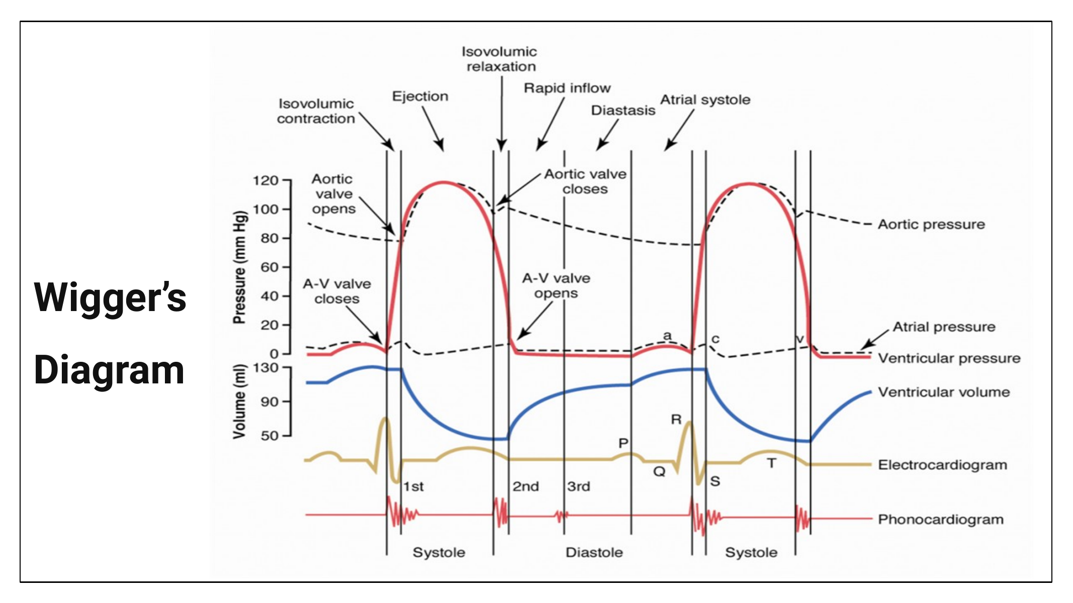 Wigger's Diagram