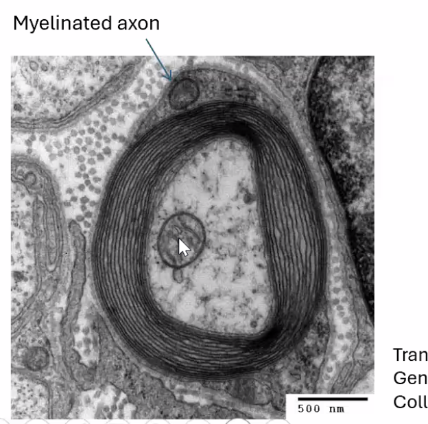 תא שוואן ומיטוכונדריה בתוך אקסון