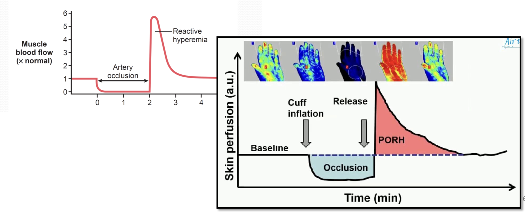 Reactive hyperemia