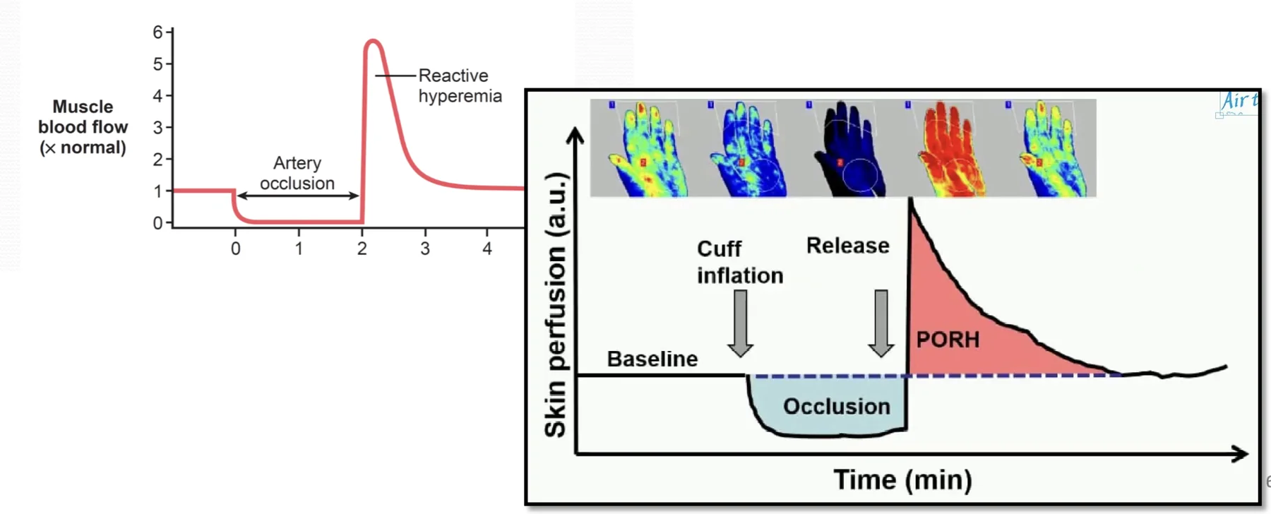 Reactive hyperemia