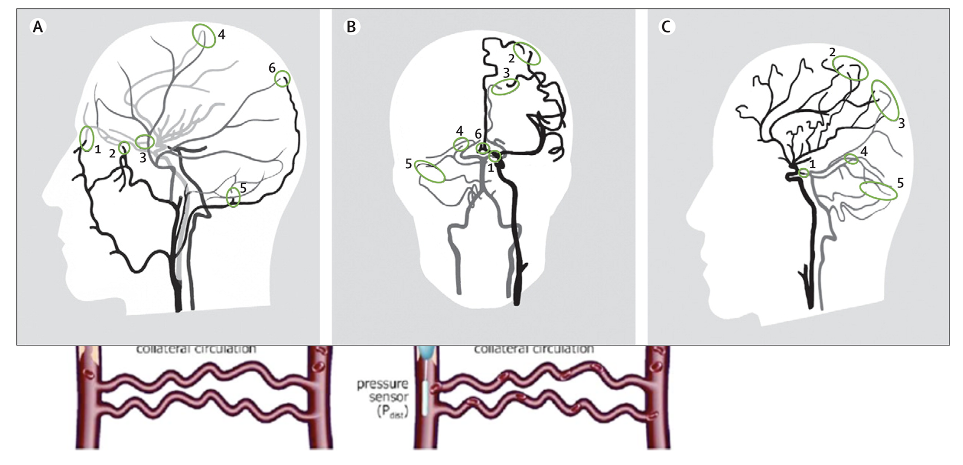 Long-Term Regulation of Blood Flow (Or MAP)
