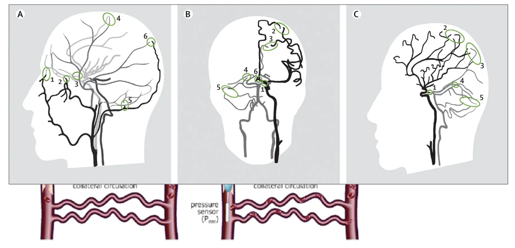 Long-Term Regulation of Blood Flow (Or MAP)