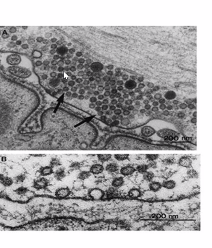 רואים הרבה וסיקולות מלאים בנויורוטרנסמיטרים