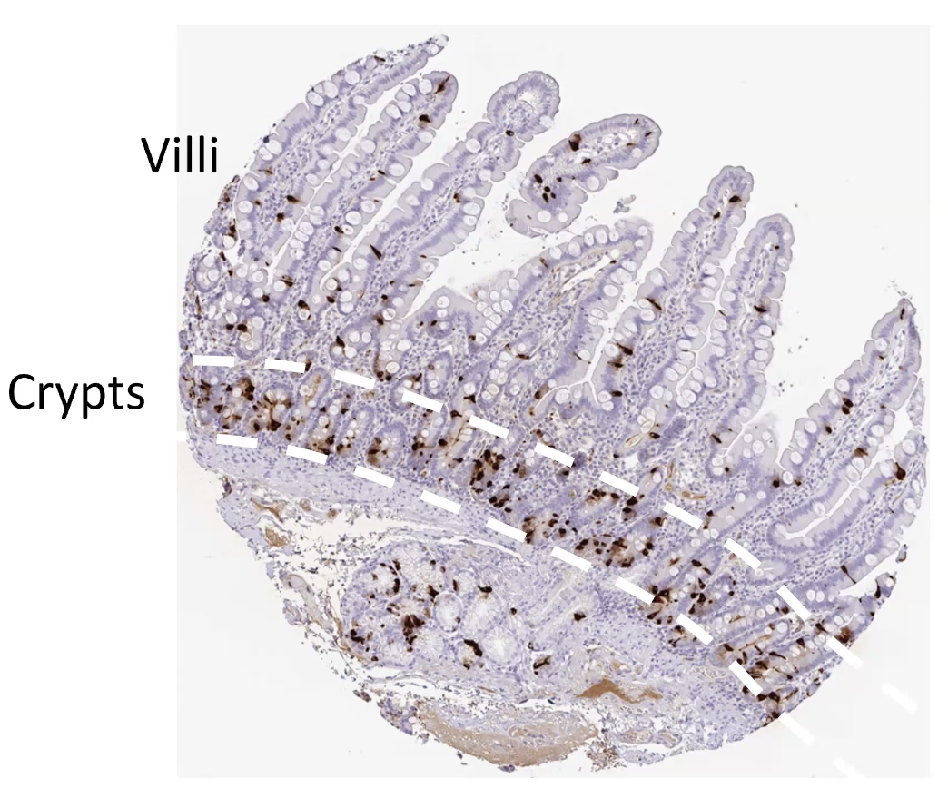 EE-cells בצבע חום, גרעין בכחול וציטוזול בסגול