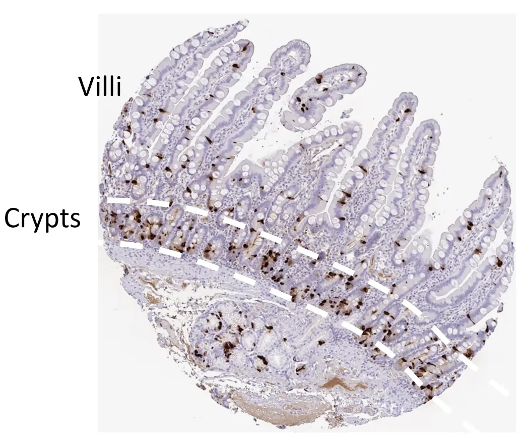 EE-cells בצבע חום, גרעין בכחול וציטוזול בסגול