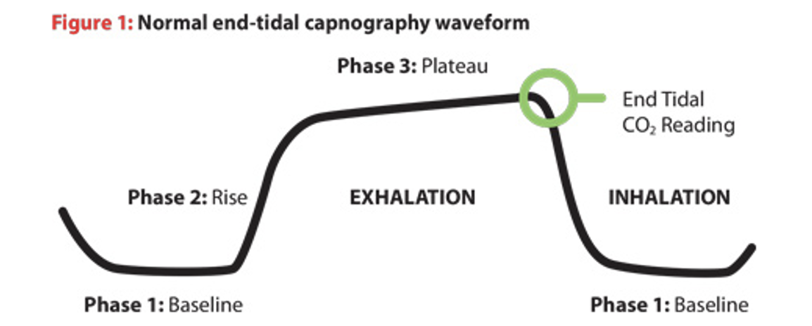 Normal end-tidal capnography waveform