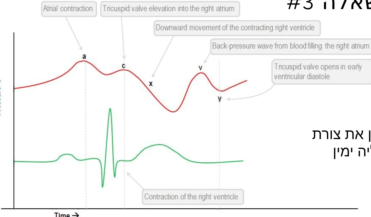 CVP waves